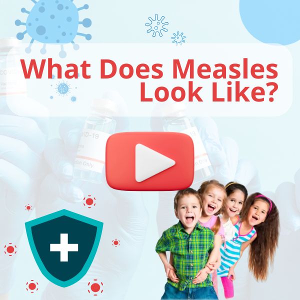 Watch: What Does Measles Look Like?